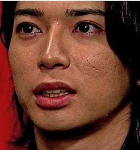二股騒動渦中、松本潤の汚肌が話題