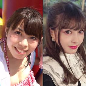 コスプレイヤー明治が700万整形を披露