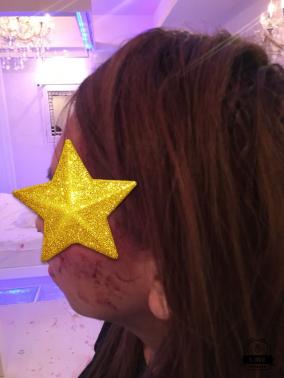 本番拒否・客に切りつけられたデリヘル嬢が被害をTwitterに投稿