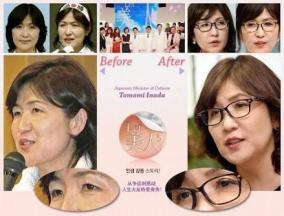 稲田朋美防衛大臣整形説