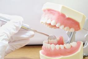 奥歯まで保険適用でセラミック歯を入れられる魔法の言葉