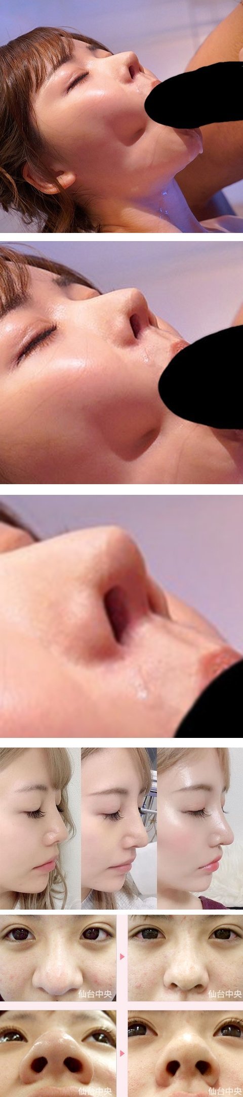 鼻が整形の女性5マイ連続画像