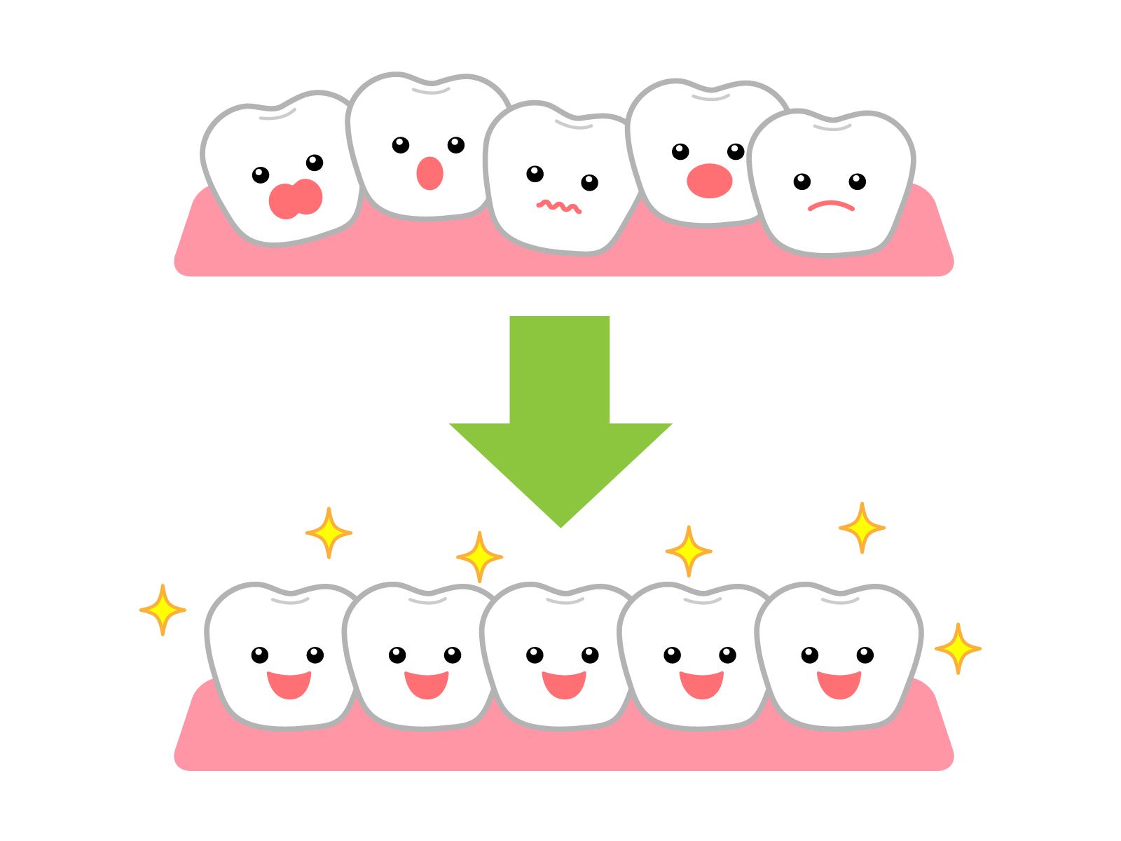 歯列矯正のイメージ