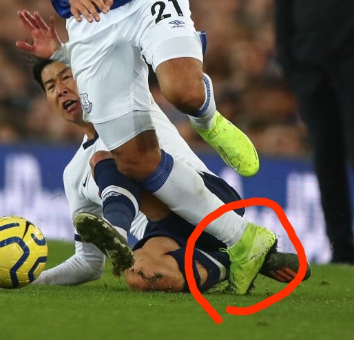 足首を負傷するサッカー選手